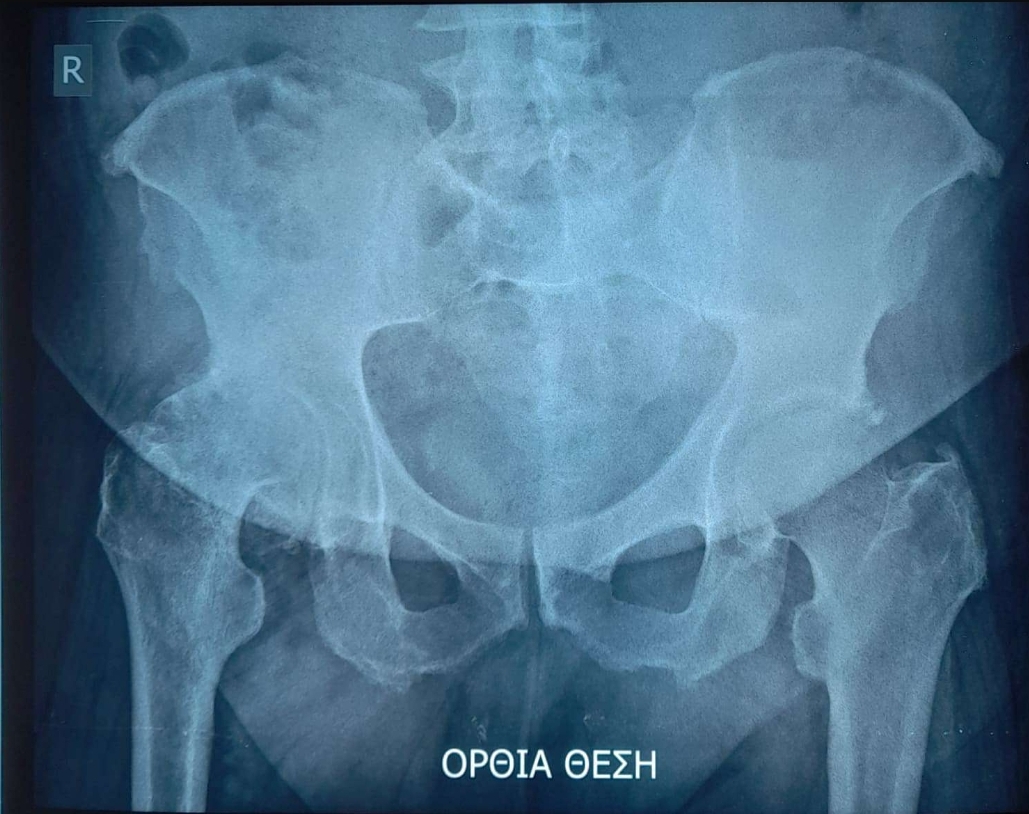 Αβραμίδης Γρηγόριος 